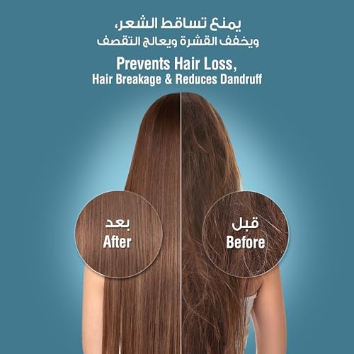 Blu Ionic Shower Head and Shower Filter - Handheld - Removes Chlorine & Harmful Pollutants - Prevent Hair Loss & Moisturize Your Skin, Chrome - Medaid