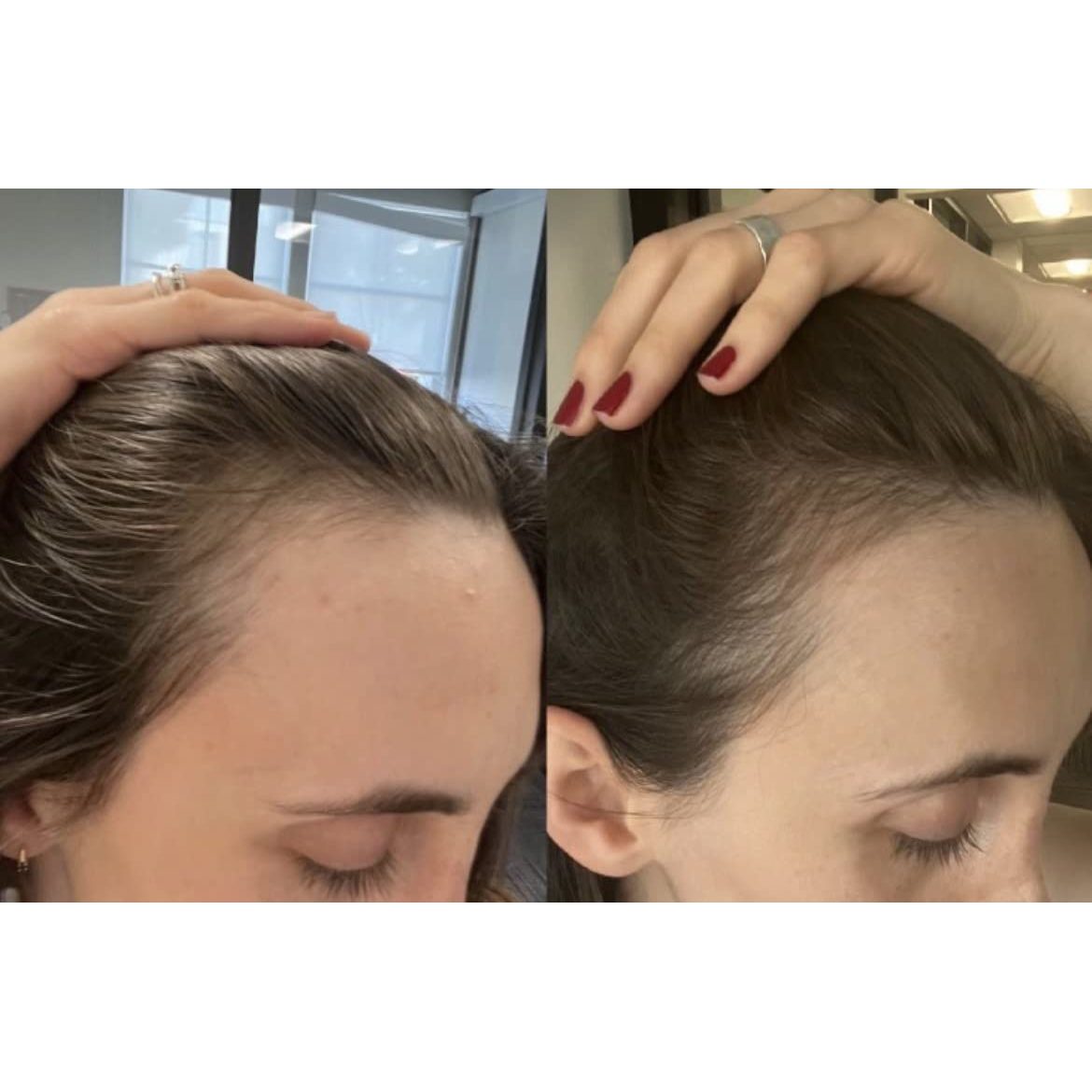 bur bur - Growing Season Hair Growth And Repair Oil | 50 mL - Medaid