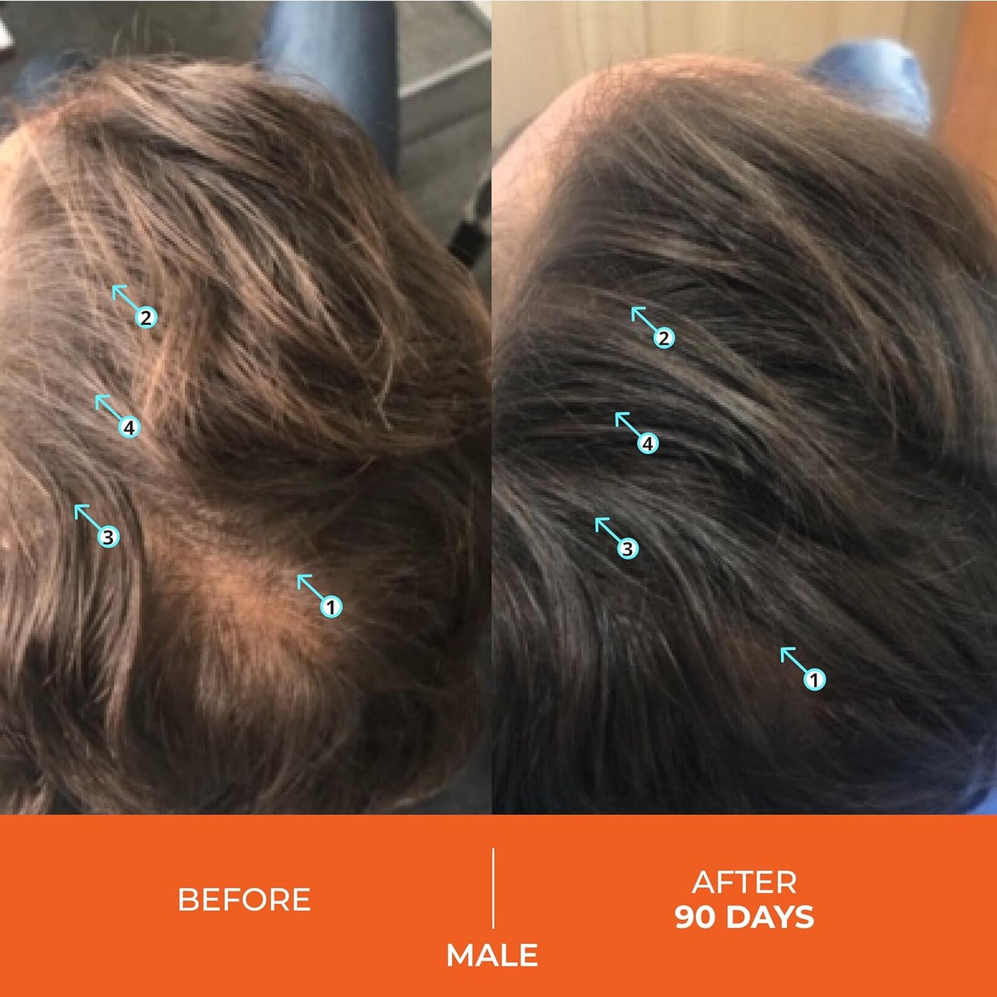 DS Laboratories Revita - Hair Growth and Thickening Shampoo with DHT Blocker, Biotin for Hair Regrowth Treatment for Women and Men - Medaid