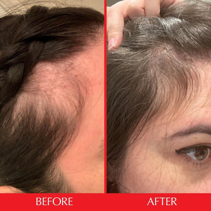 Hairtamin Gummy Star - Medaid International