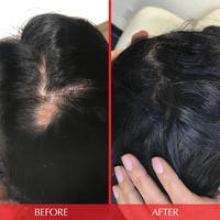 Hairtamin Advanced Formula - Medaid