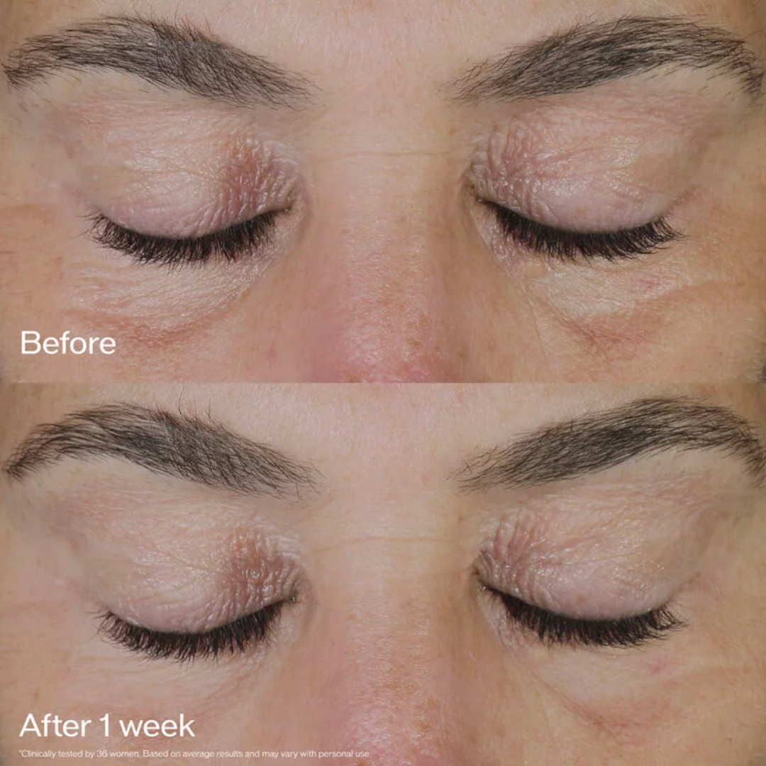 Shiseido Vital Perfection Ultra Lifting & Firming Eye Cream - Medaid