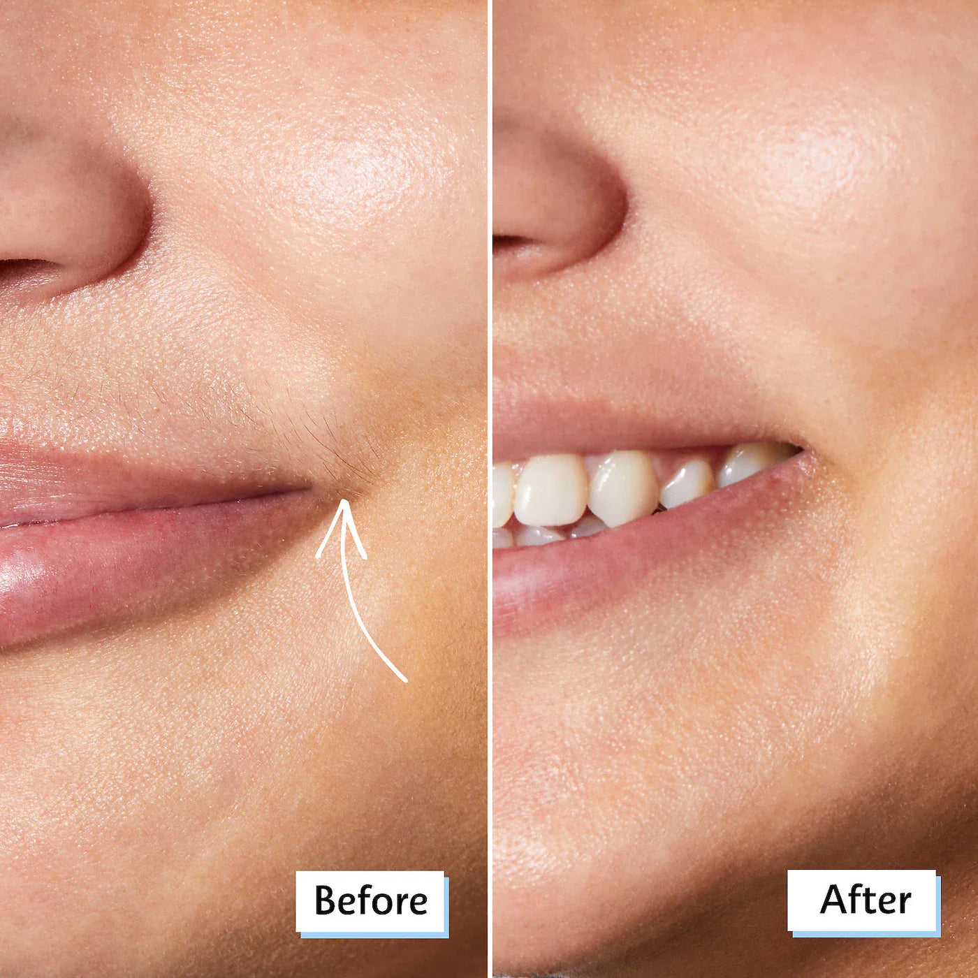 SEPHORA COLLECTION - 4 Piece Facial Razor Set - Medaid