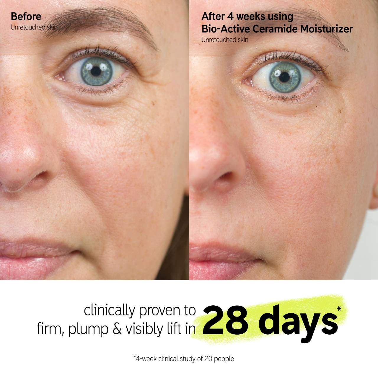 The INKEY List - Bio-Active Ceramide Repairing and Plumping Moisturizer + Barrier Strengthening | 50 mL - Medaid