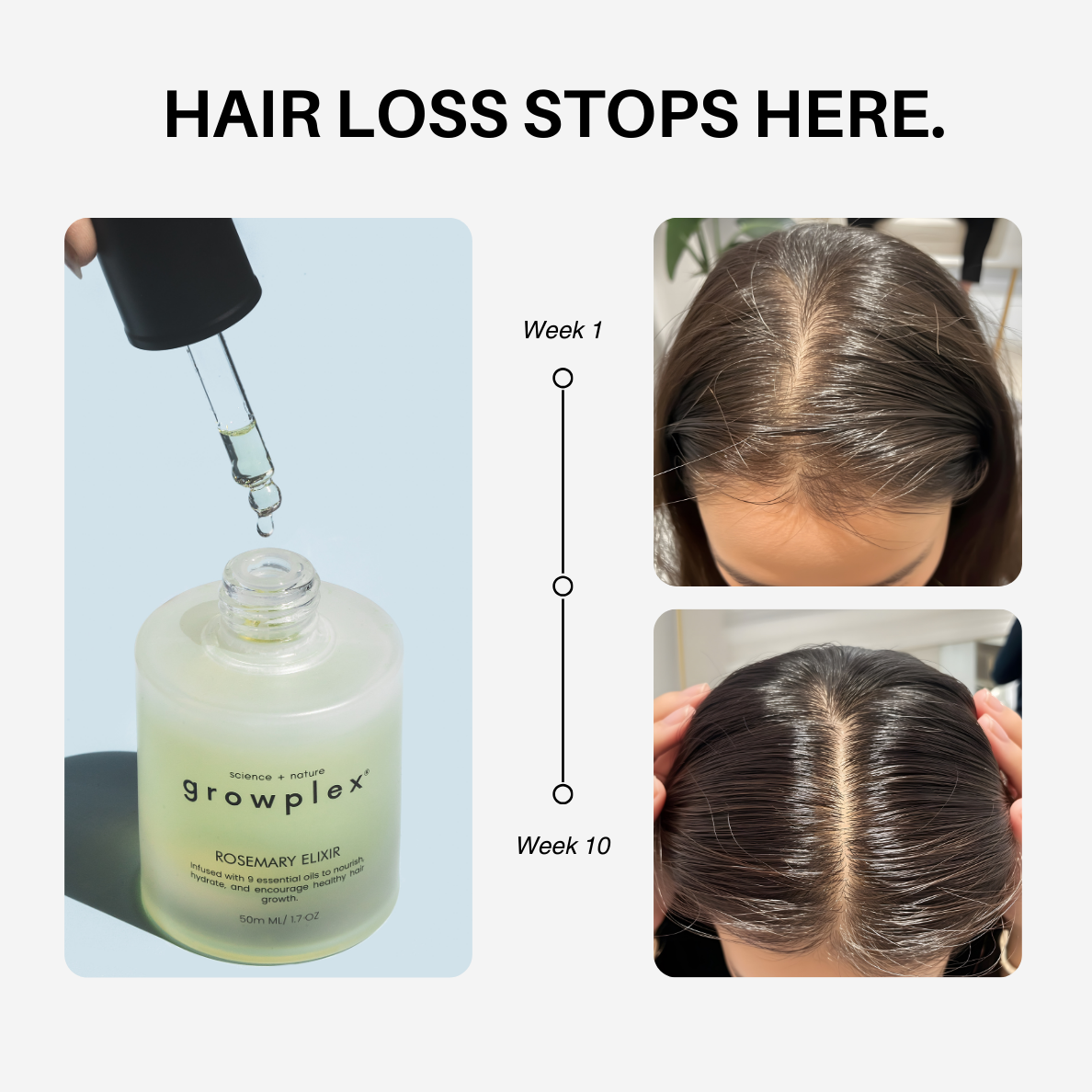 Rosemary Elixir - 100% Natural Hair Loss Solution - Medaid International