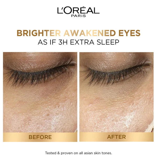 L'Oréal Paris Glycolic [3% Glycolic Acid + Vitamin CG + Niacinamide] Eye Serum for Dark circles, Brighten Eyes 20ml - Medaid