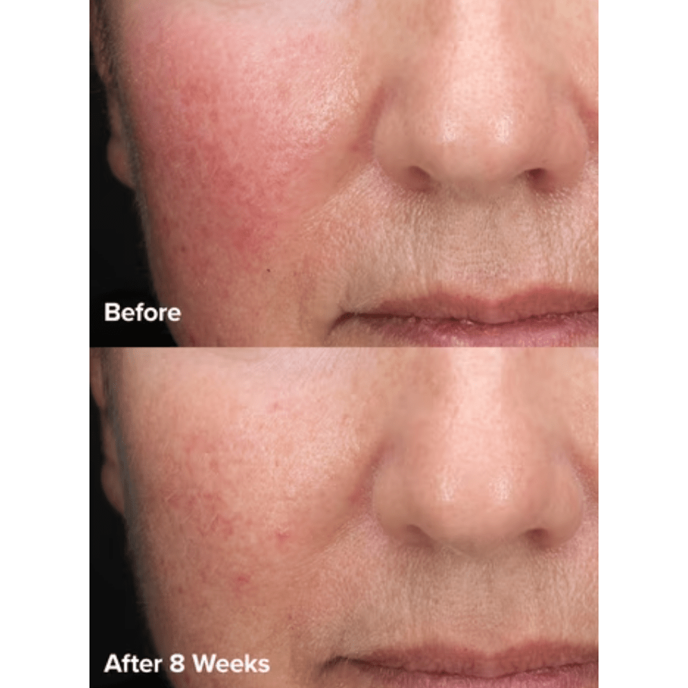 Paula's Choice - Skin Perfecting 6% Mandelic Acid + 2% Lactic Acid Liquid Exfoliant - Medaid