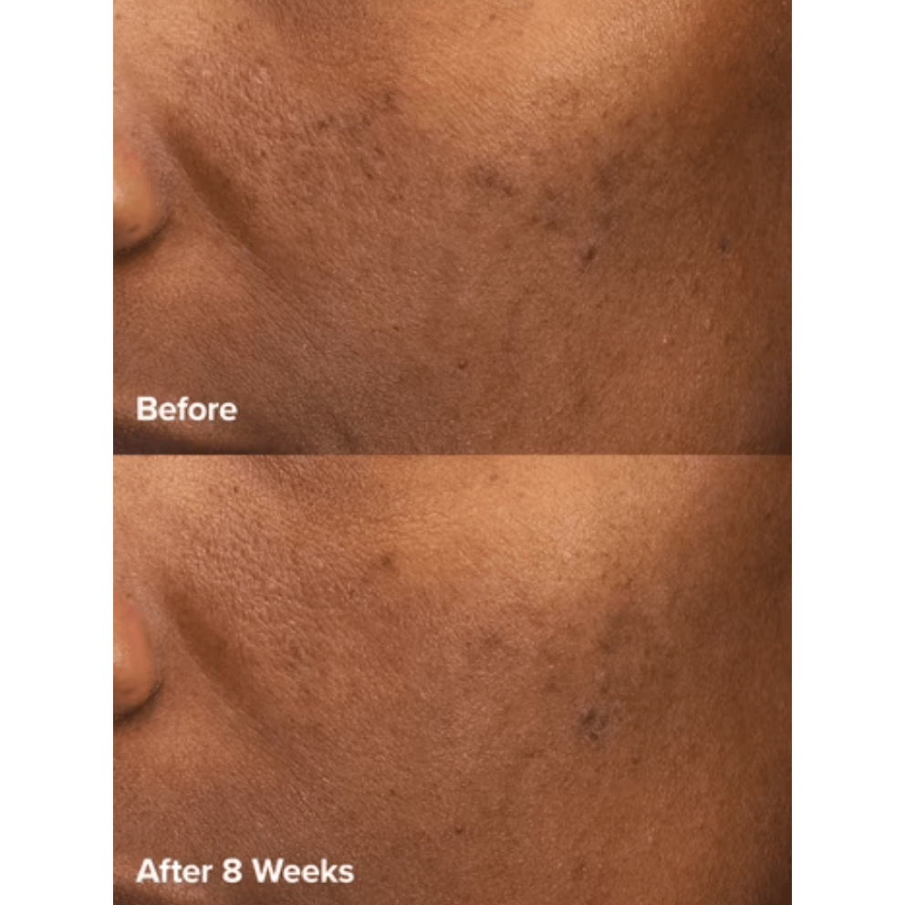 Paula's Choice - Skin Perfecting 6% Mandelic Acid + 2% Lactic Acid Liquid Exfoliant - Medaid