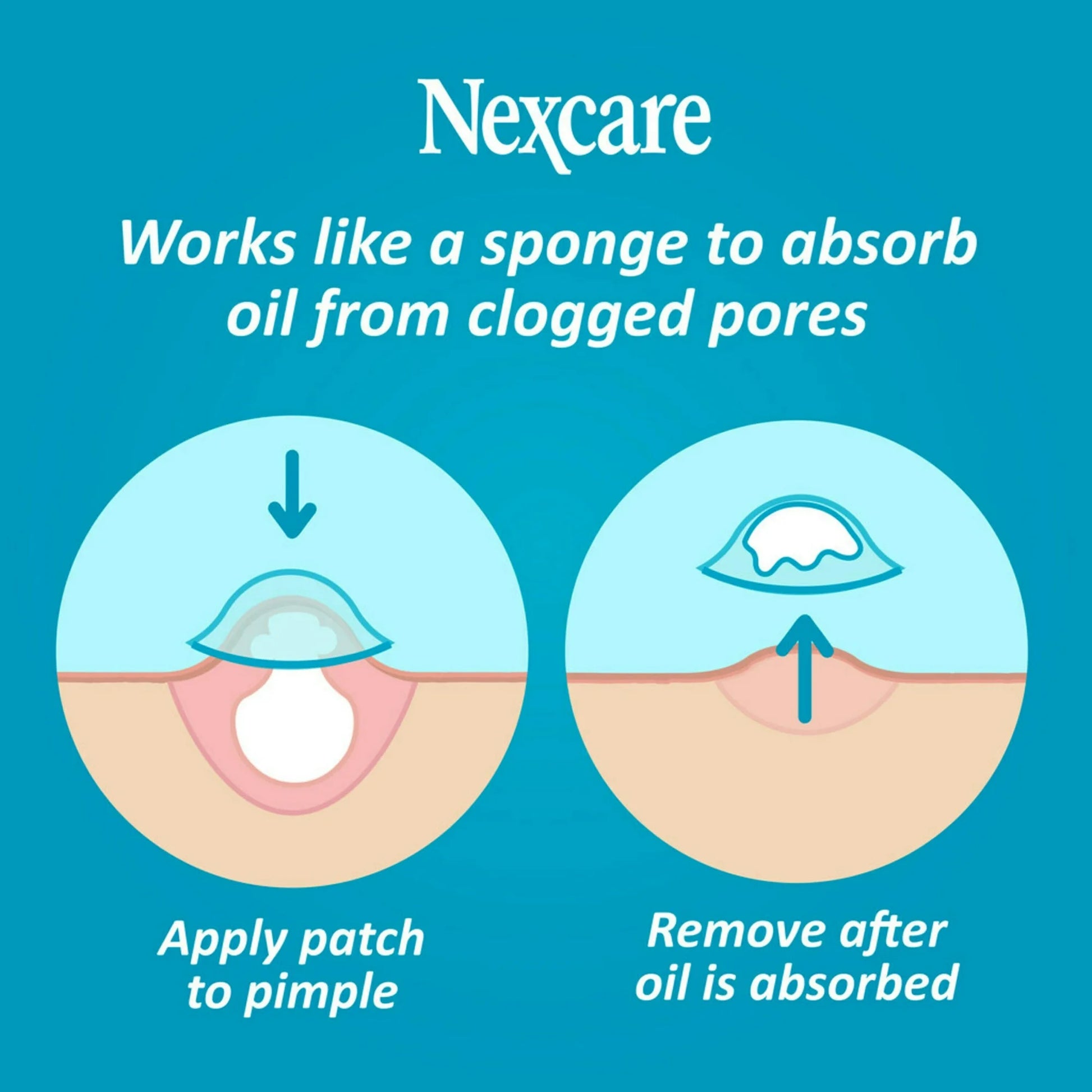 Nexcare Acne Cover for Clogged Pores - 36 Acne Covers - Medaid