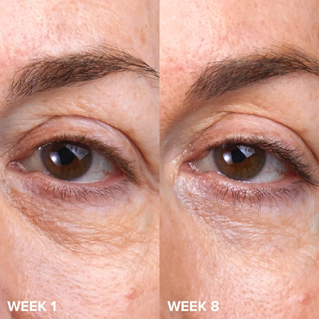 Paula's Choice - C5 Super Boost Vitamin C Eye Cream | 15 mL - Medaid