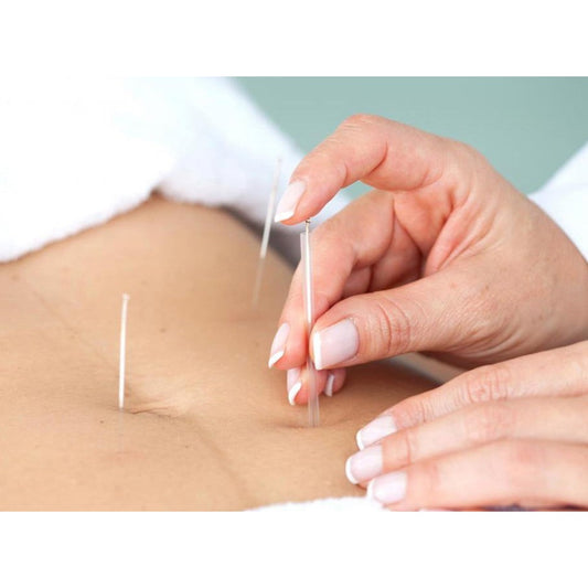 Acupuncture Therapy 30min (Pre-order 48 hours) - Medaid